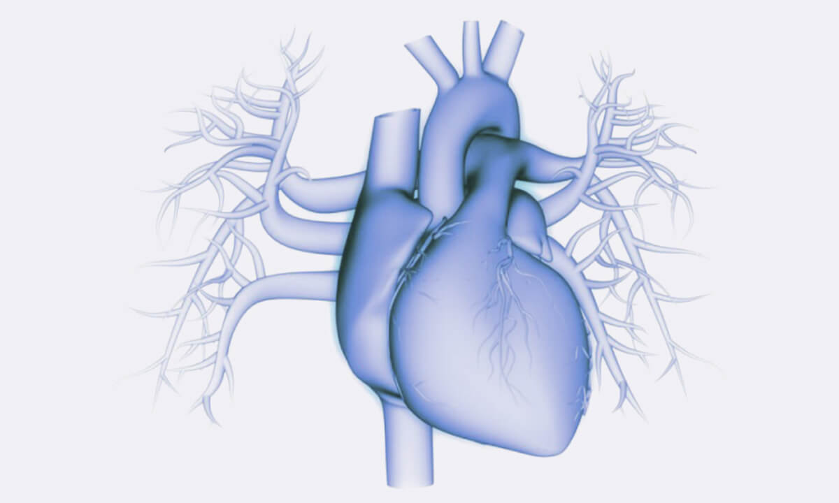 cardiac imaging